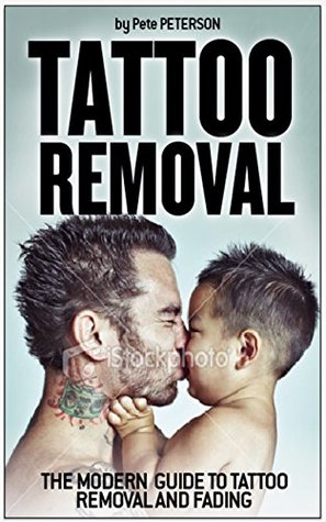 Read online Laser Tattoo Removal Guide - The Perfect Guide And What You Must Know About Removing Your Tatto For Life - Damian Belak | PDF