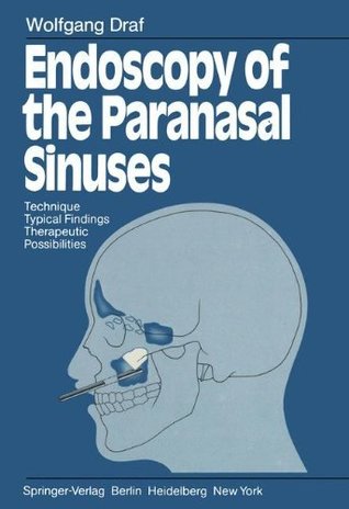 Read Endoscopy of the Paranasal Sinuses: Technique · Typical Findings Therapeutic Possibilities - Wolfgang Draf | ePub