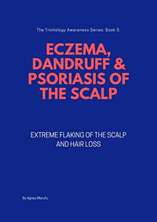 Read ECZEMA, DANDRUFF & PSORIASIS OF THE SCALP: Extreme flaking of the scalp and hair loss (The trichology awareness series Book 3) - Agnes Marufu file in ePub